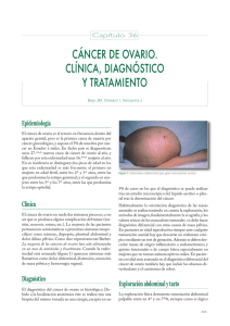 cáncer de ovario. clínica, diagnóstico y tratamiento