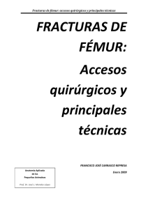 FRACTURAS DE FÉMUR: Accesos quirúrgicos y principales técnicas