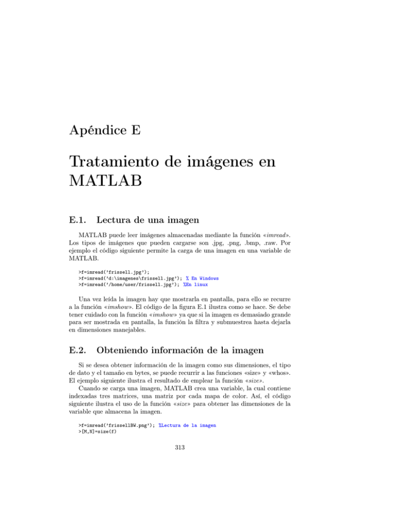 Tratamiento de imágenes en MATLAB