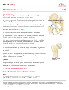 Osteoartritis de cadera - American Academy of Orthopaedic Surgeons