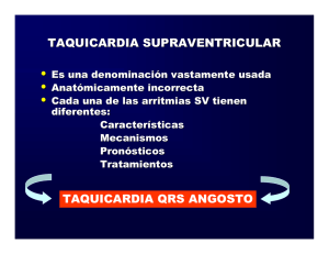 Taquicardia Paroxística Supraventricular