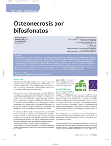 Osteonecrosis por bifosfonatos (Santolaya Diego. Ballester