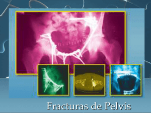 fracturas de pelvis - Facultad de Medicina de la UANL