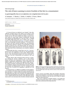 The role of bone scanning in severe frostbite of the feet in a