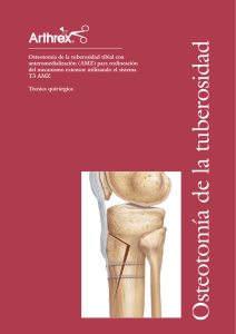 Osteotomía de la tuberosidad tibial con