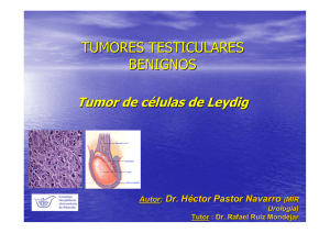 Tumores testiculares benignos. Tumor de células de Leydig.