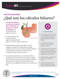 ¿Qué son los cálculos biliares?