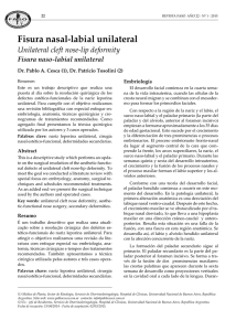 Fisura nasal-labial unilateral