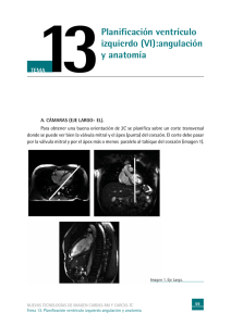 Planificación ventrículo izquierdo (VI):angulación y anatomía