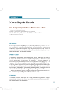 Miocardiopatía dilatada