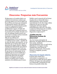 Glaucoma: Preguntas más Frecuentes