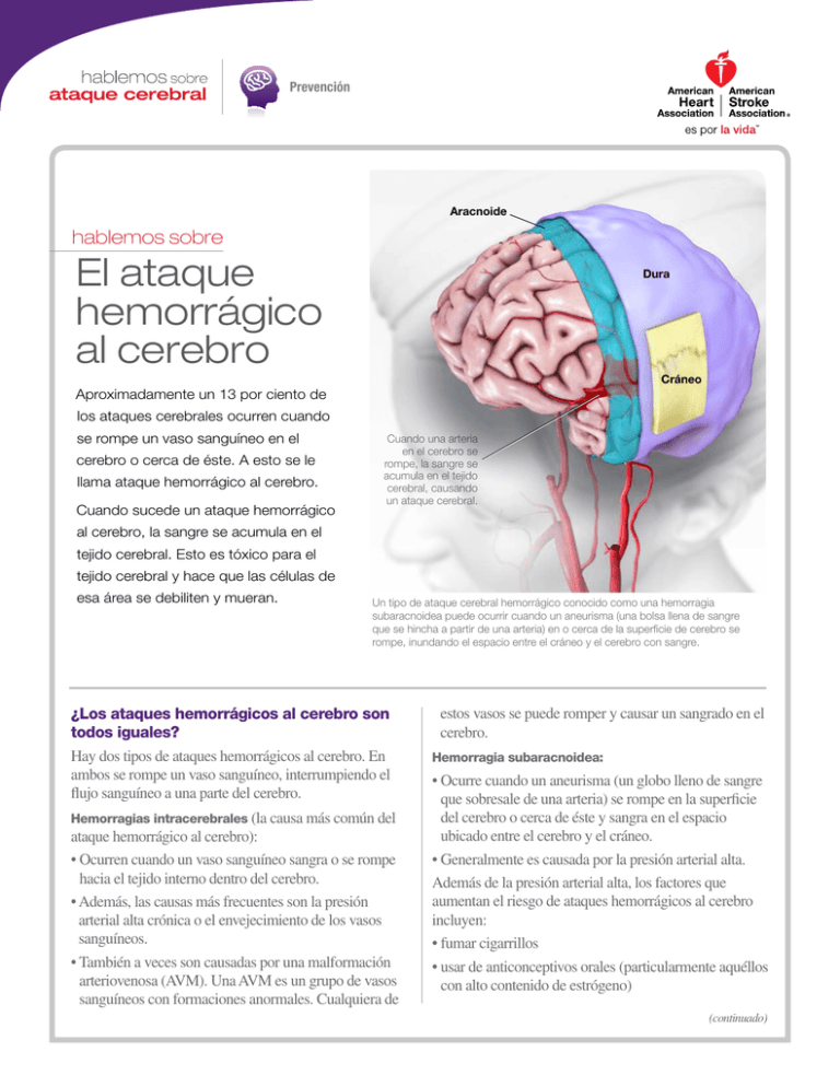 El Ataque Hemorrágico Al Cerebro