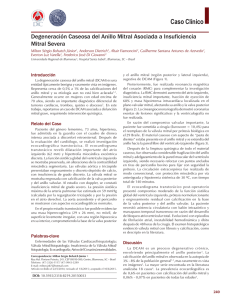 Degeneración Caseosa del Anillo Mitral