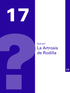 ¿Qué es la Artrosis de Rodilla?