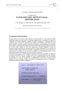 patología del septum nasal. septoplastia