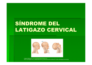 Latigazo cervical