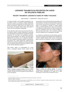 lesiones traum&aacute;ticas recientes en casos de violencia familiar