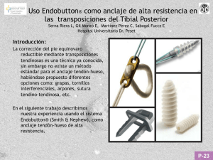 Uso Endobutton® como anclaje de alta resistencia en las