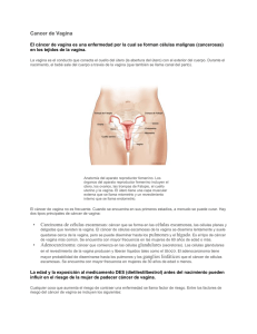 Cancer de Vagina • Carcinoma de células escamosas: cáncer que