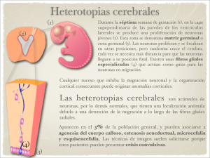 Heterotopias cerebrales