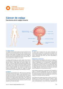 Cáncer de vejiga - Carcinoma de la vejiga urinaria