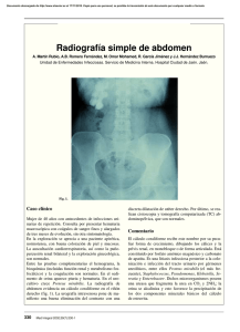 Radiografía simple de abdomen
