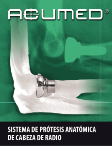 sistema de prótesis anatómica