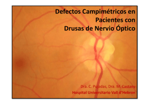 Defectos Campimétricos en Pacientes con Drusas de Nervio Óptico