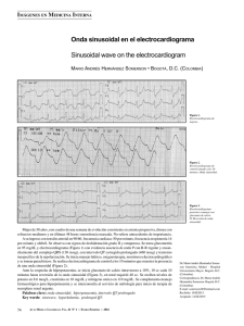 Onda sinusoidal en el electrocardiograma