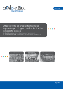 Utilización de las propiedades de los implantes para lograr una