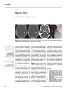 Signo de Battle - Revista de Neurología