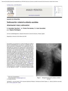 Subluxación rotatoria atlanto-axoidea