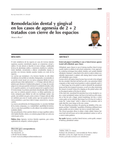 Remodelación dental y gingival en los casos de agenesia de 2 + 2