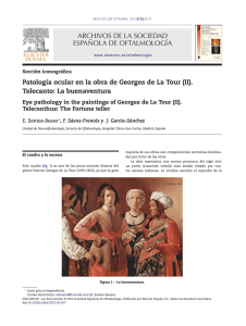 Patología ocular en la obra de Georges de La Tour (II). Telecanto