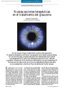 Nuevas opciones terapéuticas en el tratamiento del glaucoma
