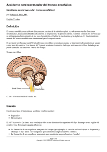 Accidente cerebrovascular del tronco encefálico