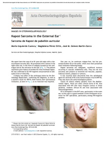 Kaposi Sarcoma in the External Ear
