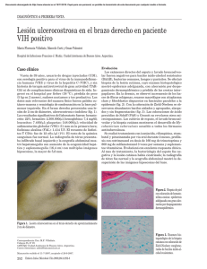 Lesión ulcerocostrosa en el brazo derecho en paciente VIH positivo