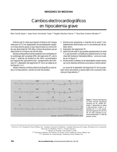 Cambios electrocardiográficos en hipocalemia grave