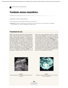 Trombosis venosa mesentérica - Revista de Gastroenterología de