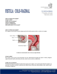 ¿Qué es la fístula colo-vaginal? - coloproctologia