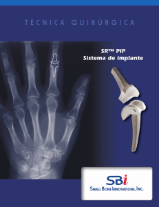 Técnica Quirúrgica - Small Bone Innovations