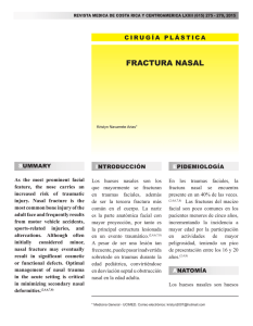 fractura nasal - edigraphic.com