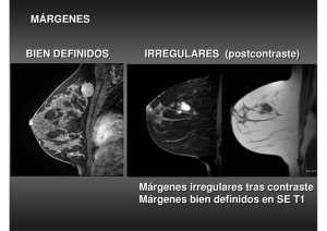 MÁRGENES BIEN DEFINIDOS IRREGULARES (postcontraste