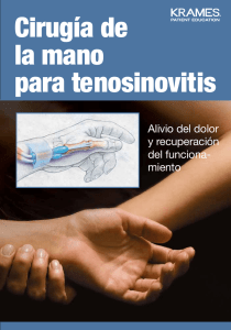 Cirugía de la mano para tenosinovitis