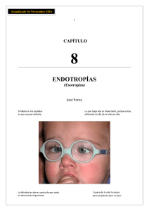 endotropías - Doctor José Perea