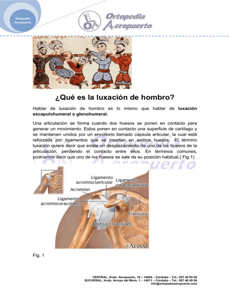 Manual Sobre La Luxación De Hombro