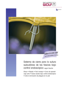Sistema de cierre para la sutura subcutánea de las