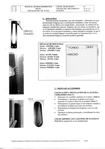 Holguras Regulación de Accesorios