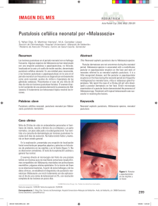 Pustulosis cefálica neonatal por «Malassezia